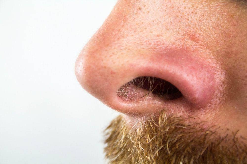 Ilustrasi bulu hidung pada bagian dalam lubang hidung manusia, menggambarkan rambut halus di area hidung.