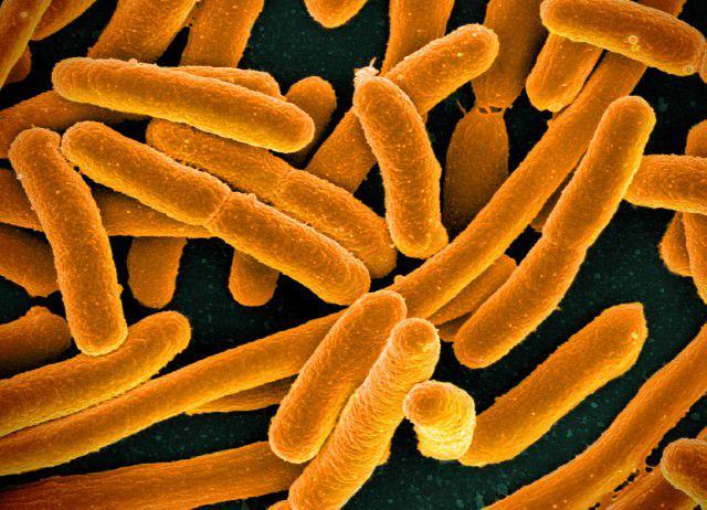 E.coli (commons.wikimedia.org/NIAID)