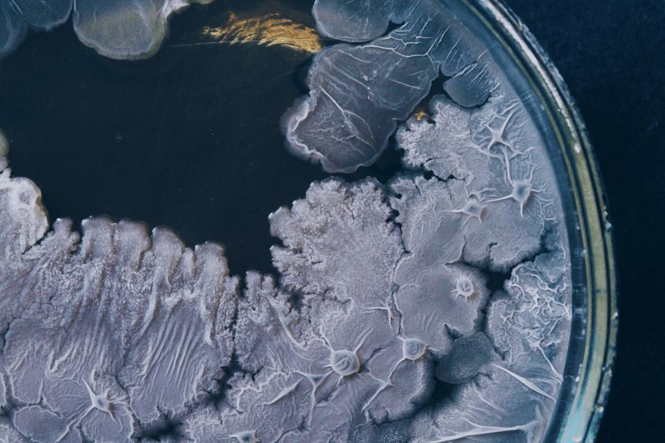 Microorganism Bacillus (commons.wikimedia.org/JuliaDavydova)