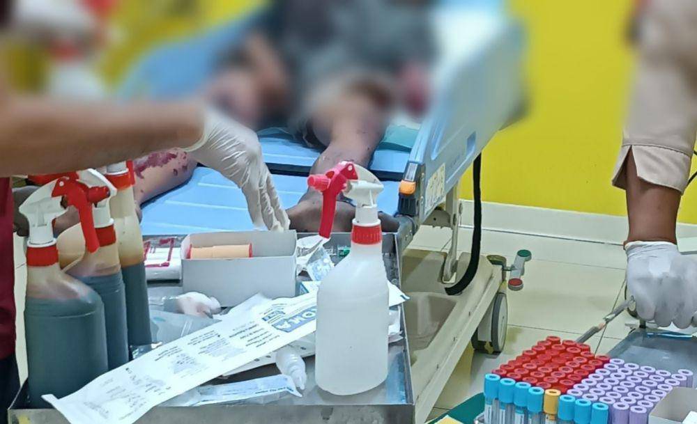 Dua korban alami luka serius dan harus dioperasi. IDN Times/ Istimewa.