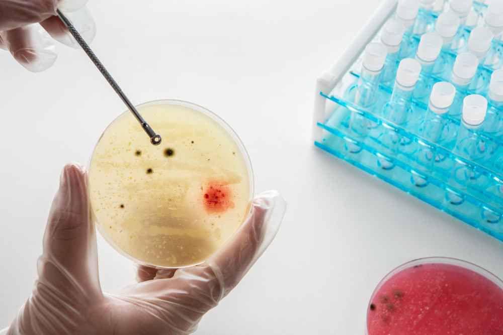 Ilustrasi Rhodosporidiobolus fluvialis, jamur yang ditemukan di rumah sakit Tiongkok (freepik.com/freepik)