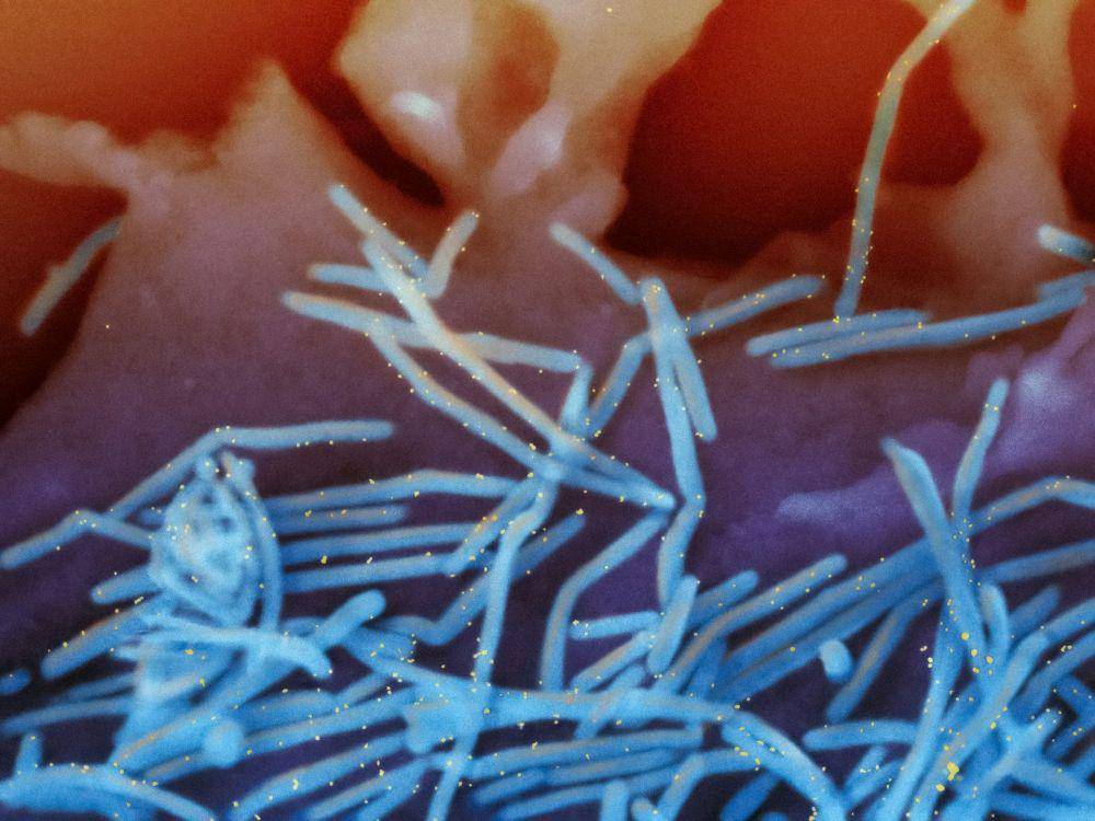 Human Respiratory Syncytial Virus (RSV) (unsplash.com/National Institute of Allergy and Infectious Diseases)