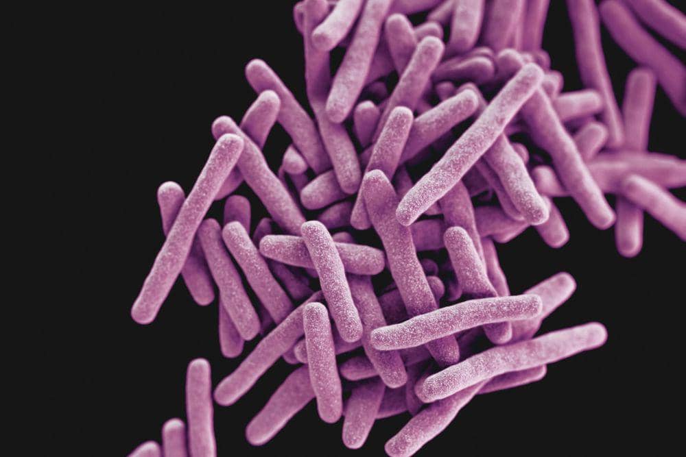 Mycobacterium tuberculosis, bakteri penyebab TBC.