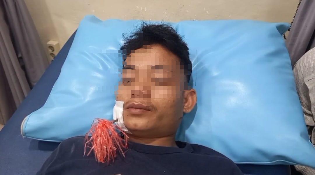 Diduga Ikut Tawuran, Pemuda di Palembang Terluka Busur Panah
