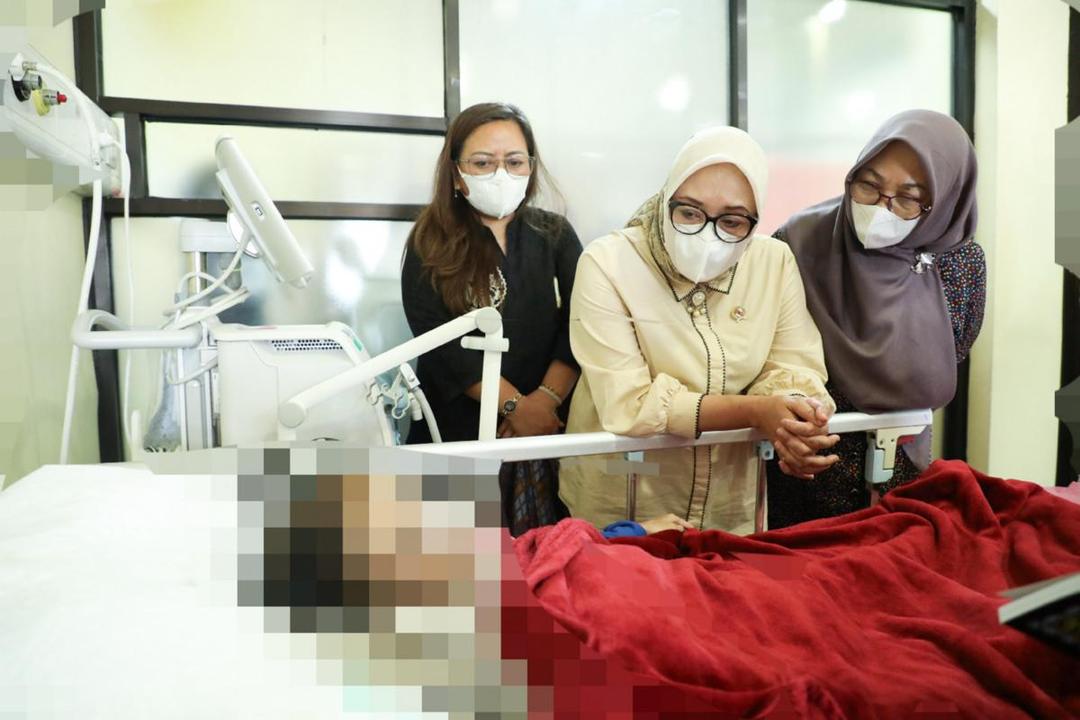 Menteri PPPA Cek Kondisi Anak yang Dibakar Ayah dan Ditelantarkan