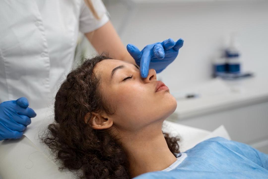Rhinoplasty Bertahan Berapa Lama? Simak Penjelasannya