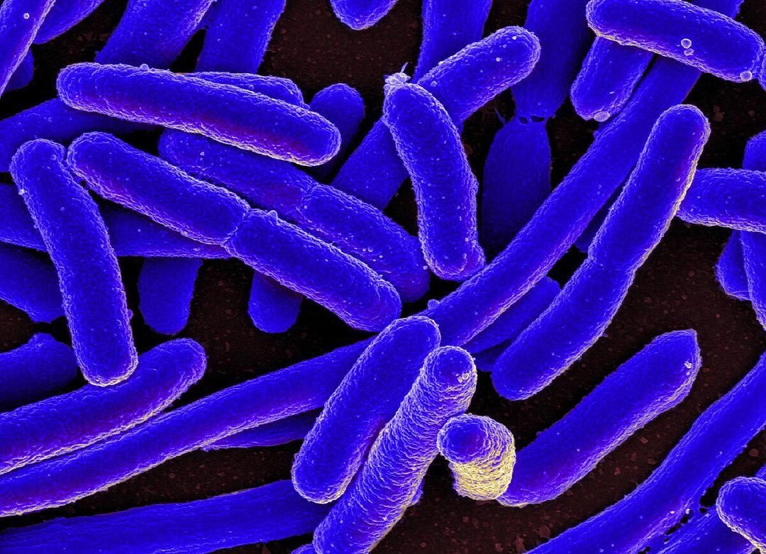 5 Fakta Escherichia coli, Bakteri yang Haram Ada di Makanan