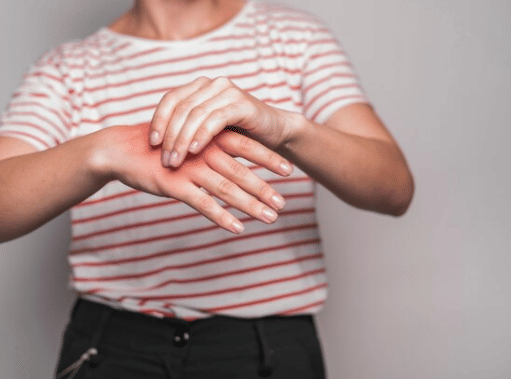 Kapan Bisul Harus Ditangani Dokter? Ini Tanda Bahayanya