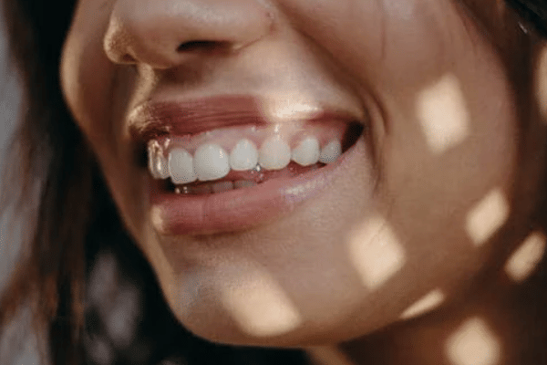 Potret gigi dan gusi yang sehat.