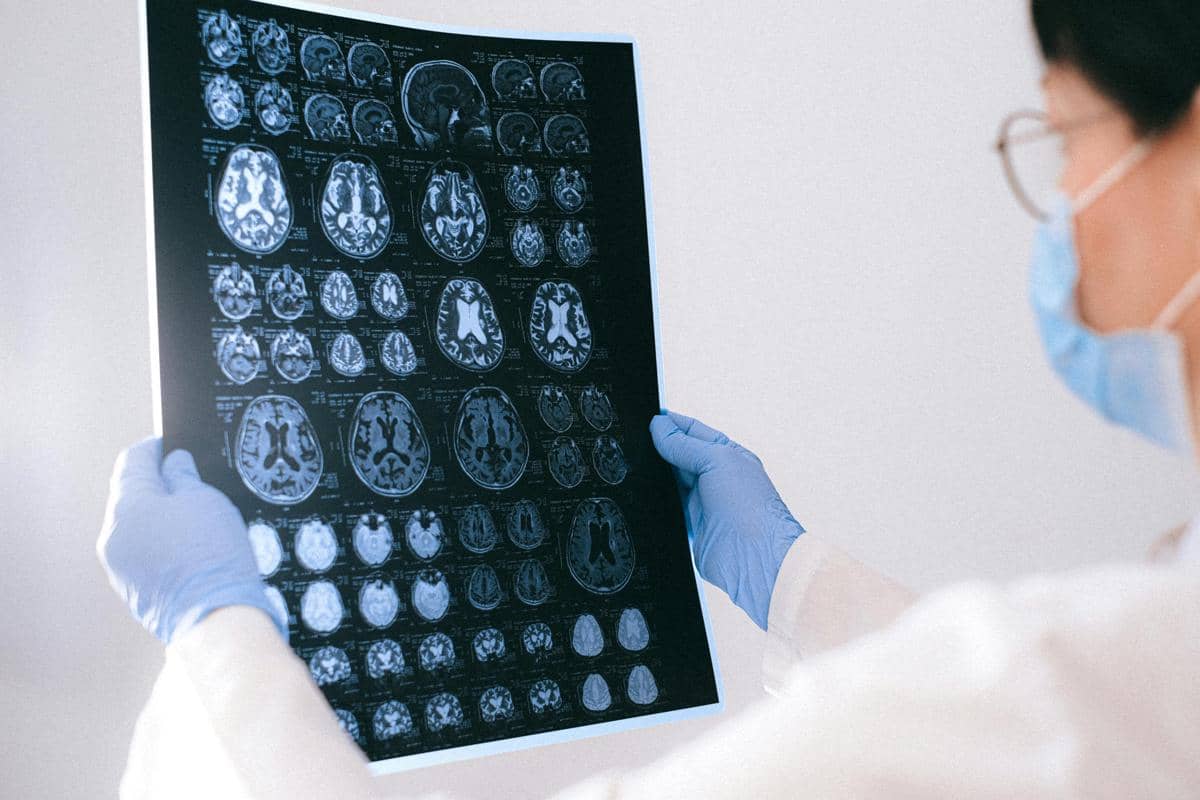 Seorang dokter berjas putih memeriksa hasil pemindaian MRI otak pasien terkait Alzheimer di layar komputer.