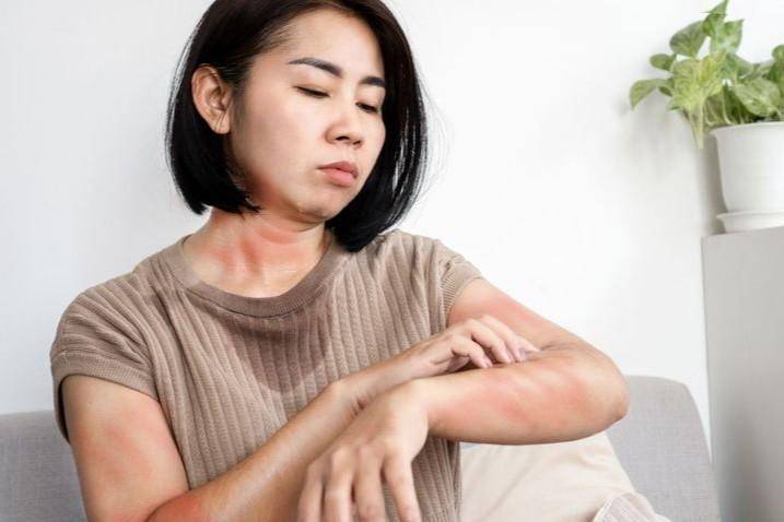 Stigma terhadap Pasien Penyakit Kulit Menular, Apakah ini Benar?