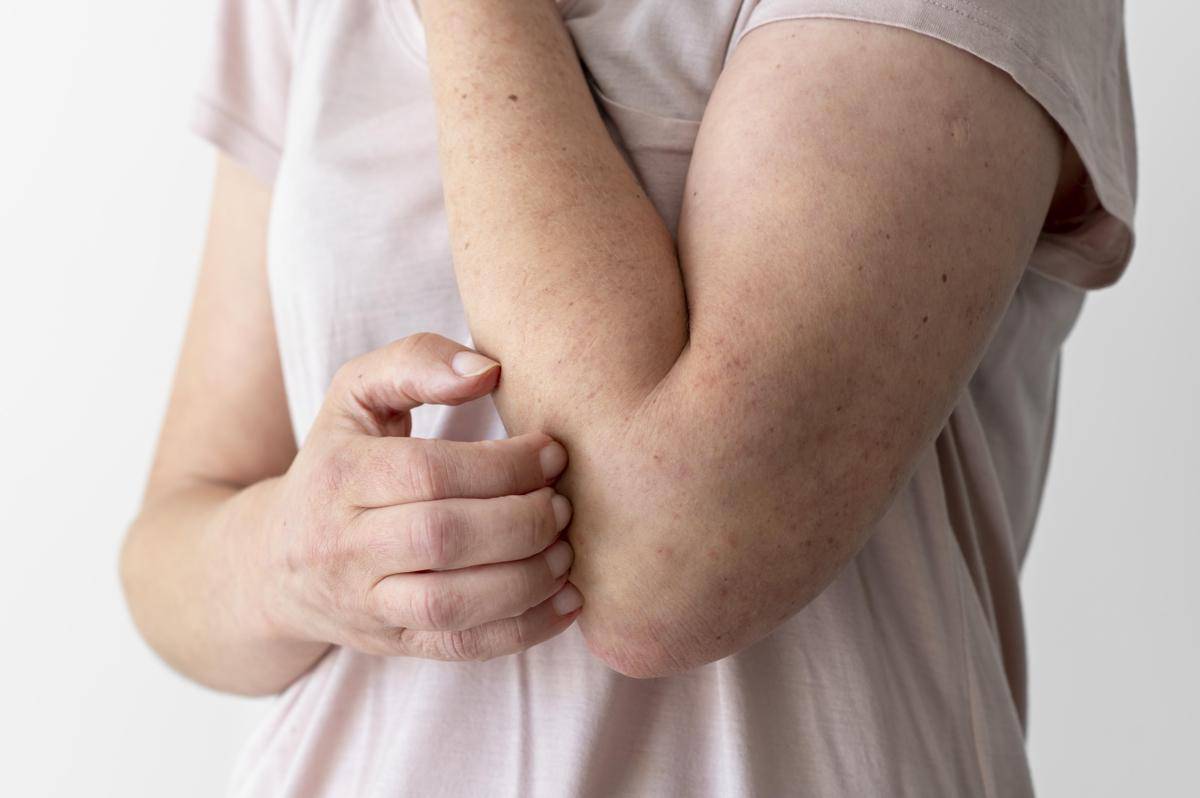 skin-allergy-reaction-person-s-arm.jpg