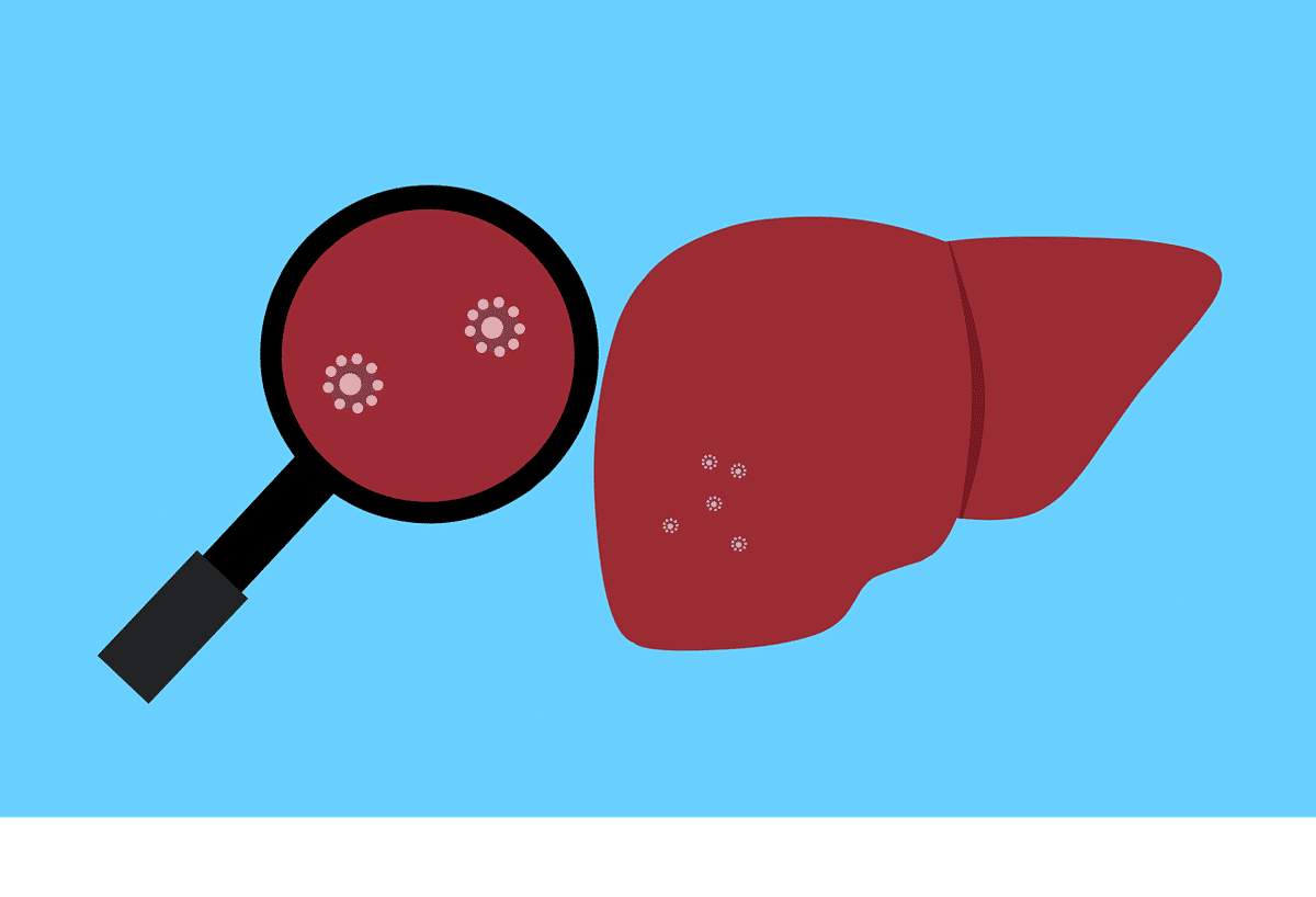 ilustrasi penyebab hepatitis (pixabay.com/Mohamed Hassan)