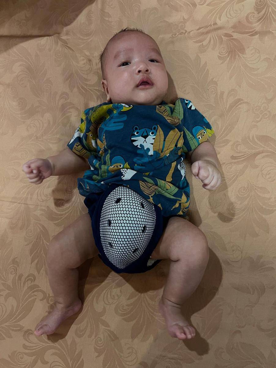 Anak Chand Kelvin Disunat usia 2,5 Bulan (Instagram.com/chand_kelvin)