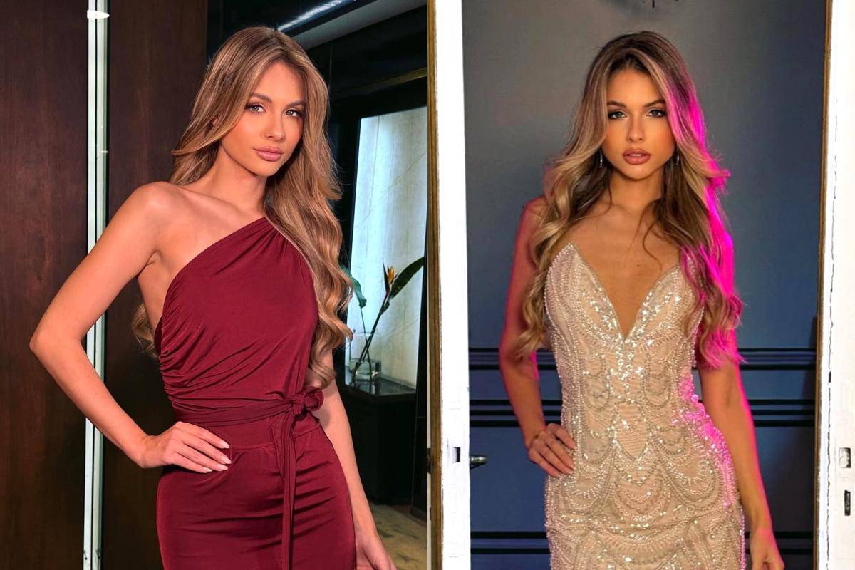 potret Aldana Masset, Miss Universe Argentina 2025 (instagram.com/aldumasset)
