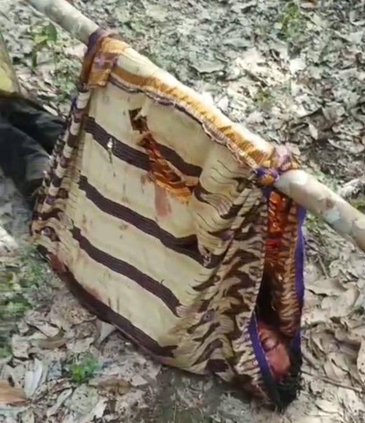 Petani karet di Mura terluka dan dilarikan ke rumah sakit diduga akibat diserang beruang (Dok: Warga) 