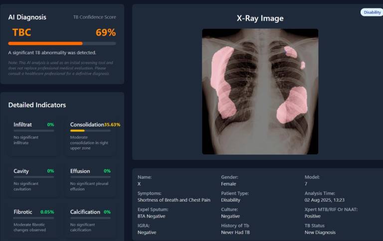 TBScreen.AI, aplikasi skrining TBC berbasis AI pertama di Indonesia. (ugm.ac.id)