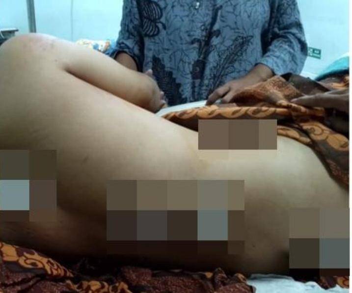 Korban Kadarta Reza saat mengalami luka usai ditusuk calon ayah mertuanya. (Dok. Polisi)