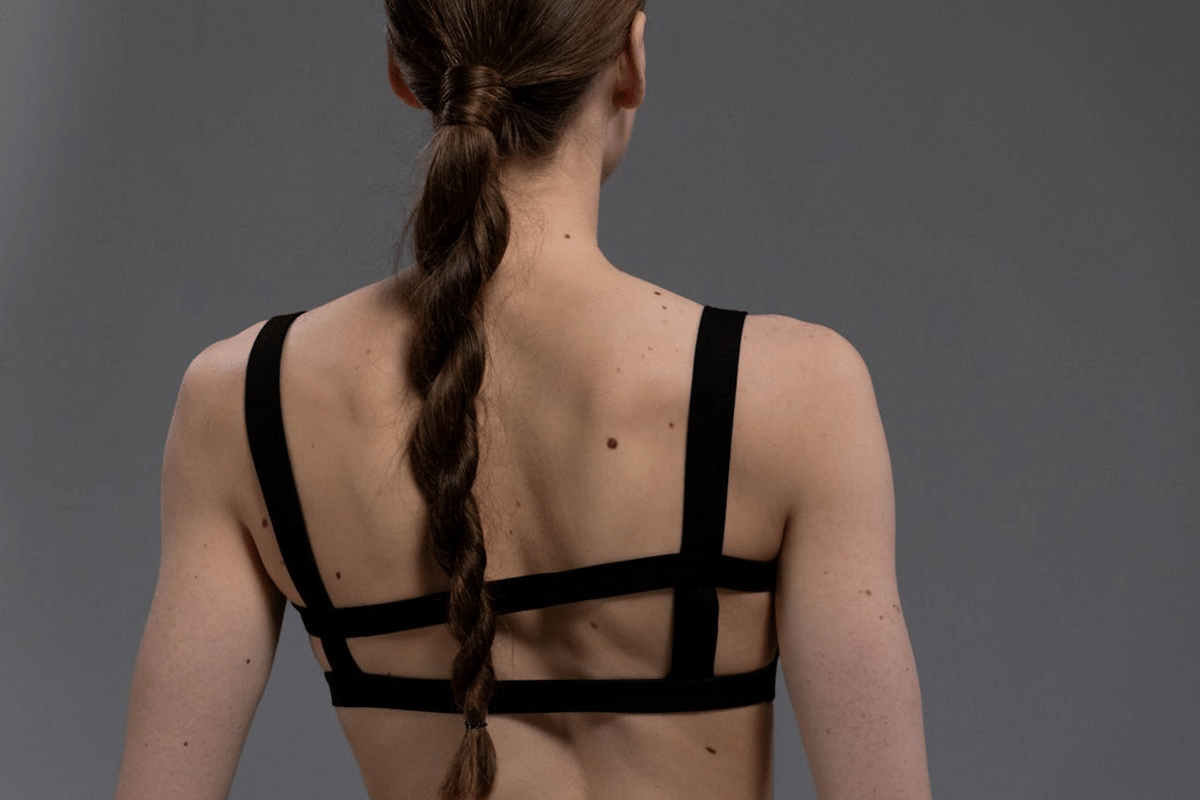 tahi lalat di tubuh perempuan