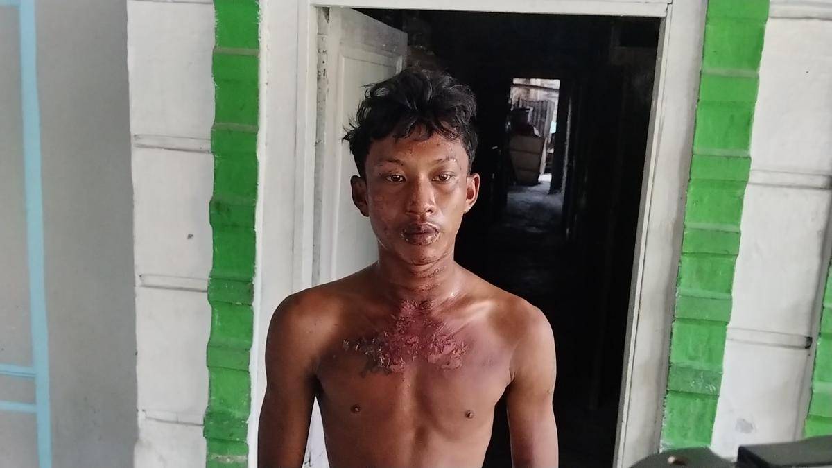 Andika selaku korban pembakaran (IDN Times/Eko Agus Herianto)