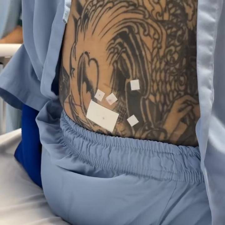 Ganindra Bimo operasi karena cedera pinggang (instagram.com/ganindrabimo)