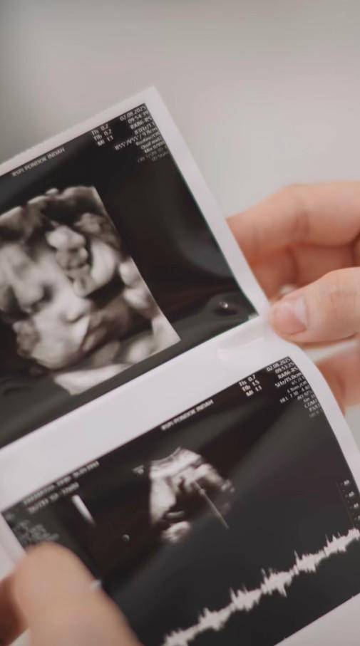 Maternity Dewi Paramita Mici (Instagram.com/paramitha)