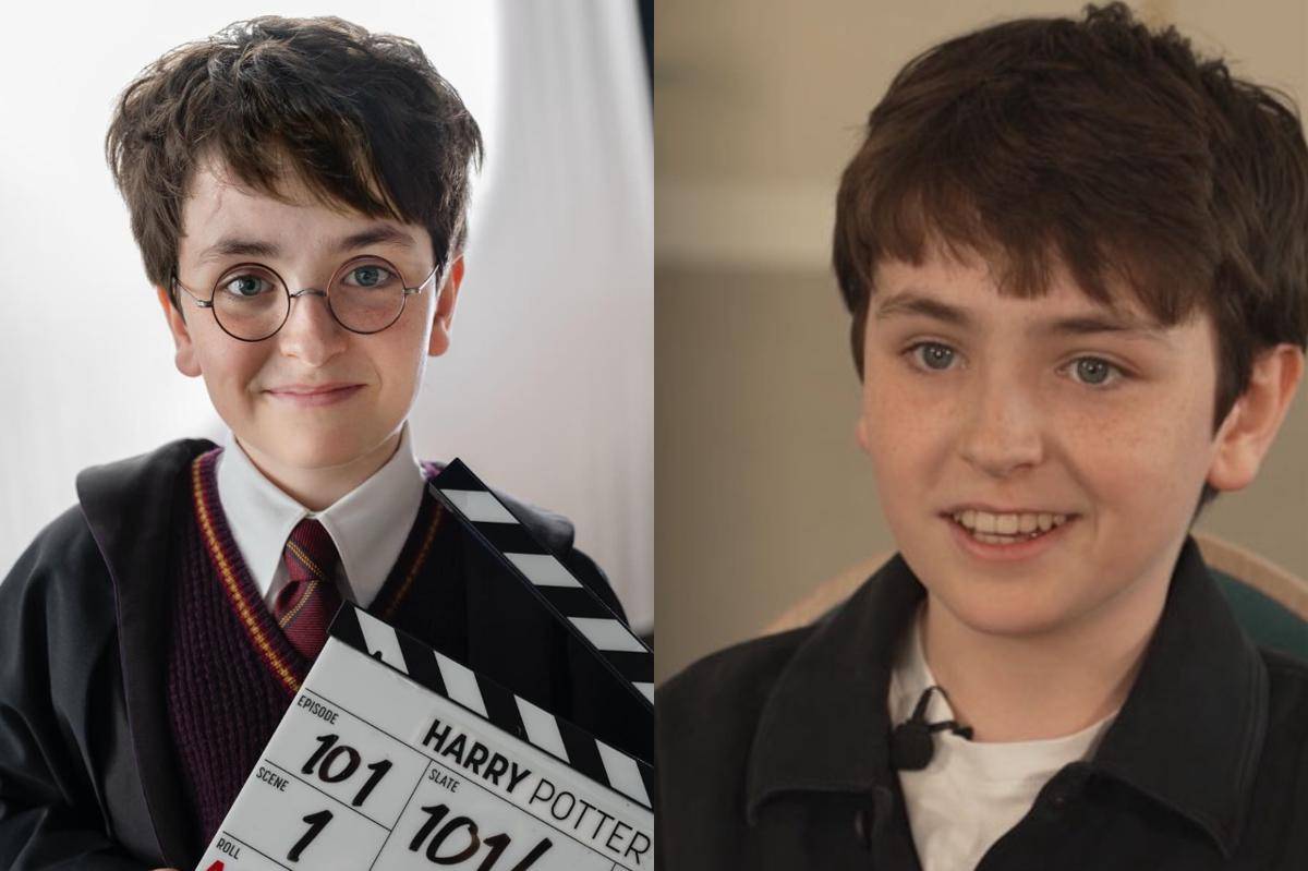 Dominic McLaughlin sebagai Harry Potter versi HBO