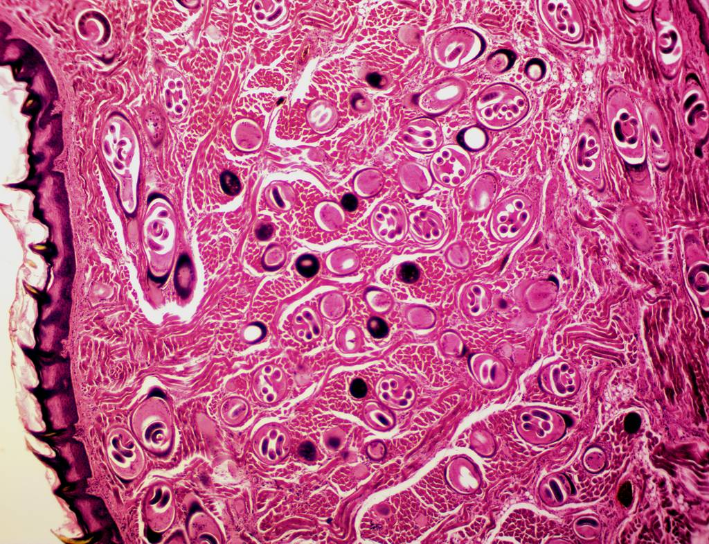 cacing trichinella spiralis di jaringan (commons.wikimedia.org/TheMrGrove)