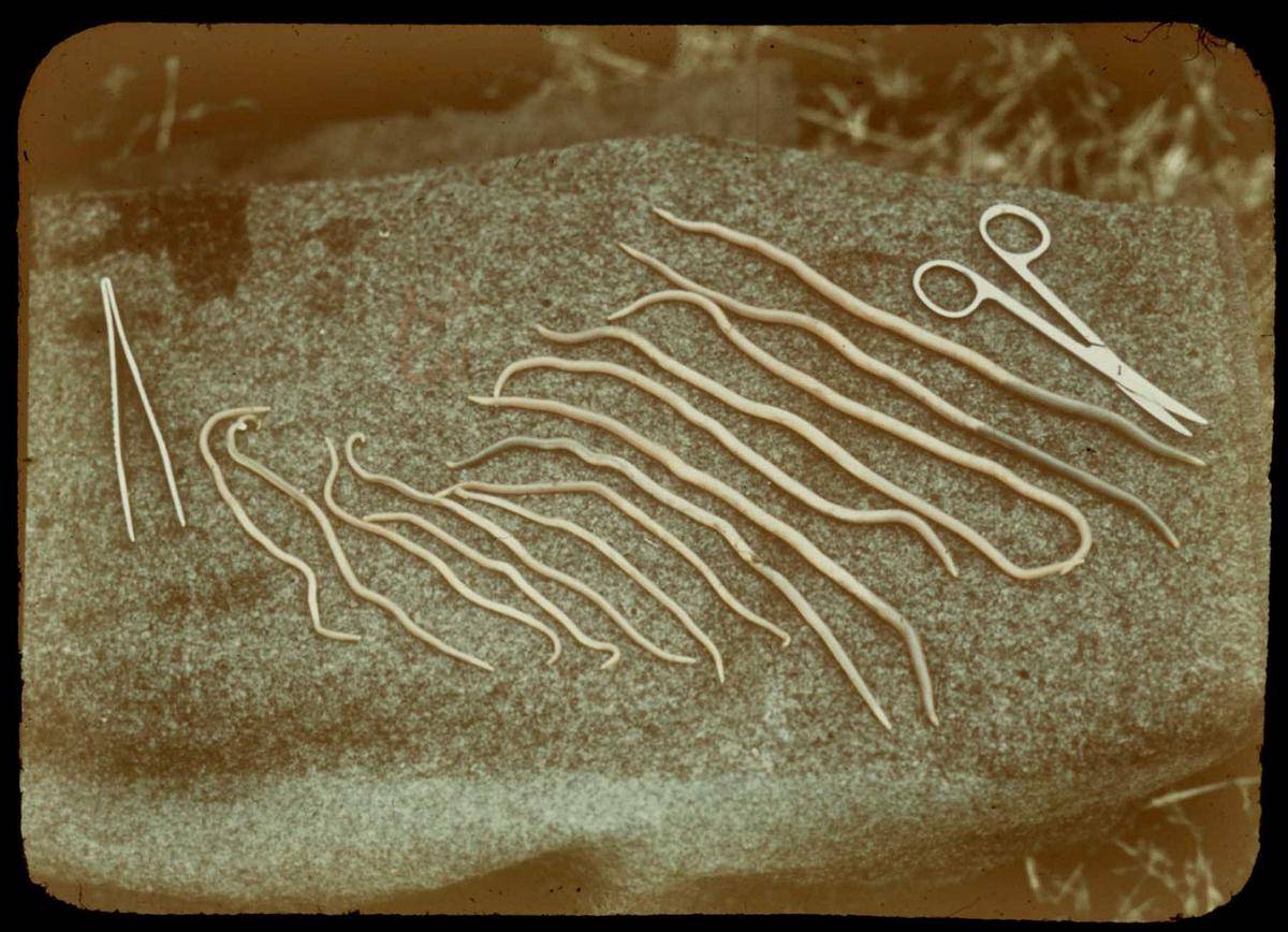 Ascaris lumbricoides