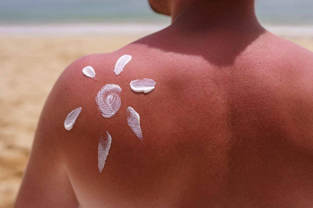 ilustrasi cowok pakai suncreen di pantai (freepik.com/freepik)