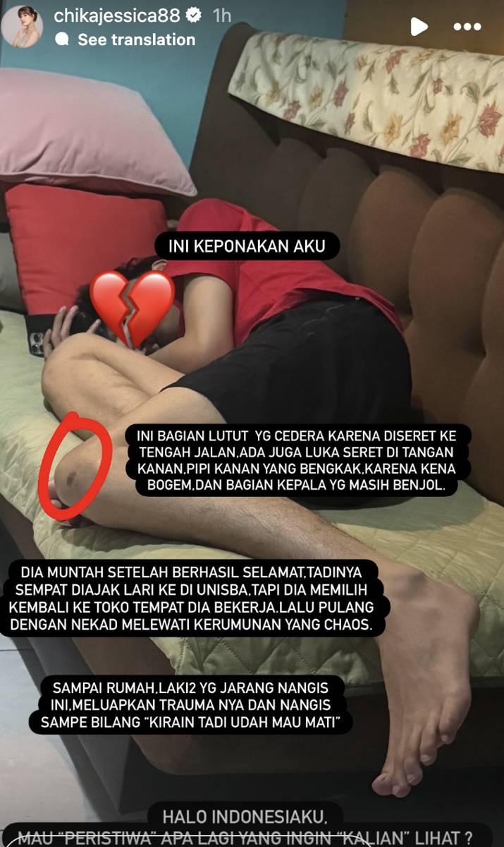 unggahan Chika Jessica soal keponakannya kena salah pukul