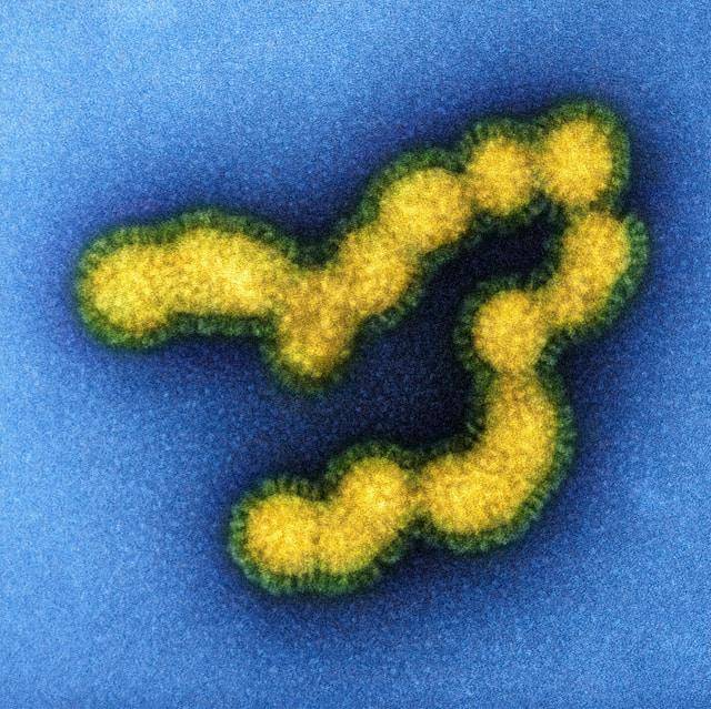 ilustrasi virus (unsplash.com/National Institute of Allergy and Infectious Diseases)