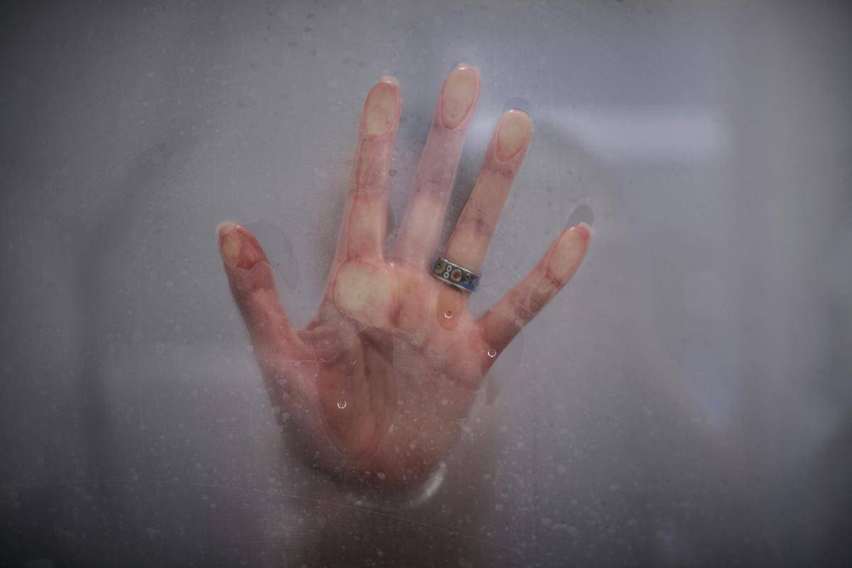 ilustrasi mendinginkan luka (unsplash.com/Alexandr Popadin)