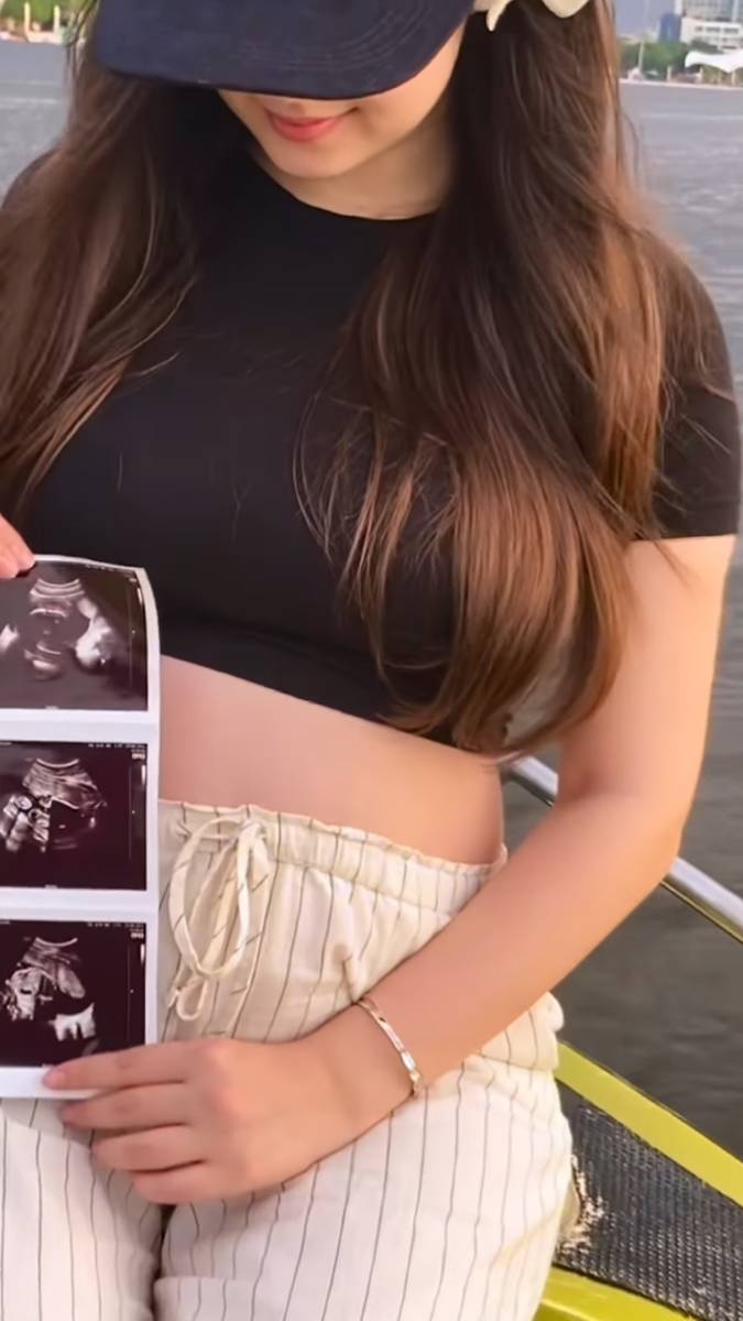 istri Billy Syahputra umumkan kehamilan