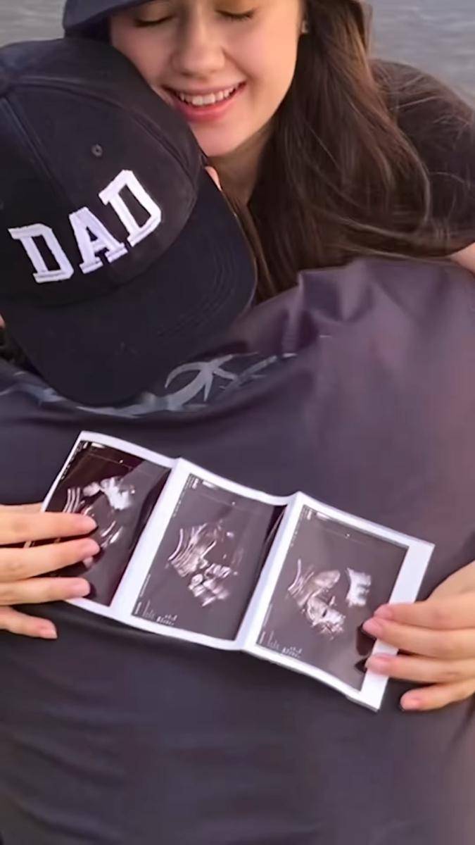 istri Billy Syahputra umumkan kehamilan