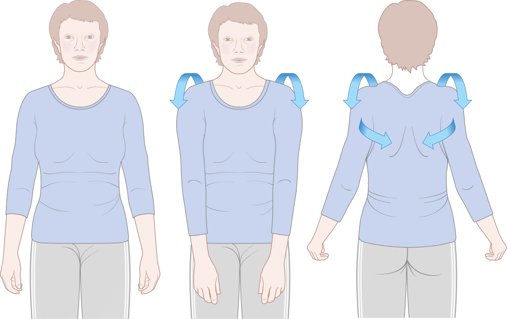 ilustrasi gerakan shoulder roll (commons.wikimedia.org/Cancer Research UK)