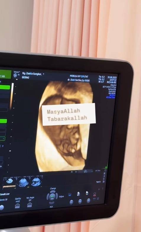Zaskia Sungkar Umumkan Kehamilan (Instagram.com/zaskiasungkar15)