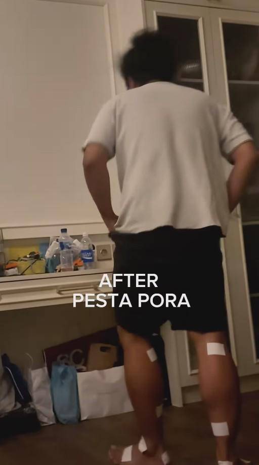 Indah Permatasari Sakit Kaki Nonton Pestapora (Instagram.com/indahpermatas)