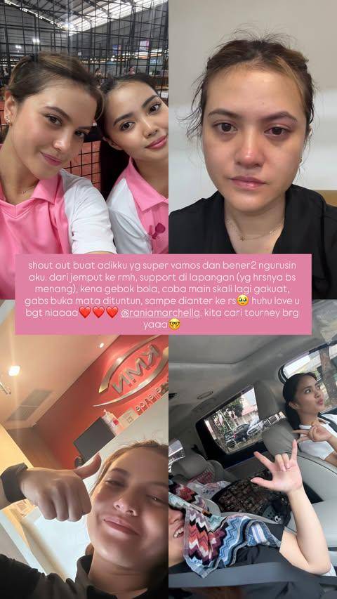 Mata Marsha Aruan Terkena Bola Padel (Instagram.com/aruanmarsha)