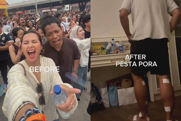 Indah Permatasari Sakit Kaki Nonton Pestapora (Instagram.com/indahpermatas)