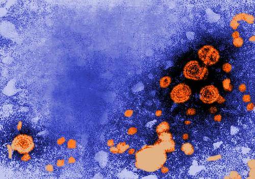 Ilustrasi virus hepatitis B (flickr.com/Microbe World)