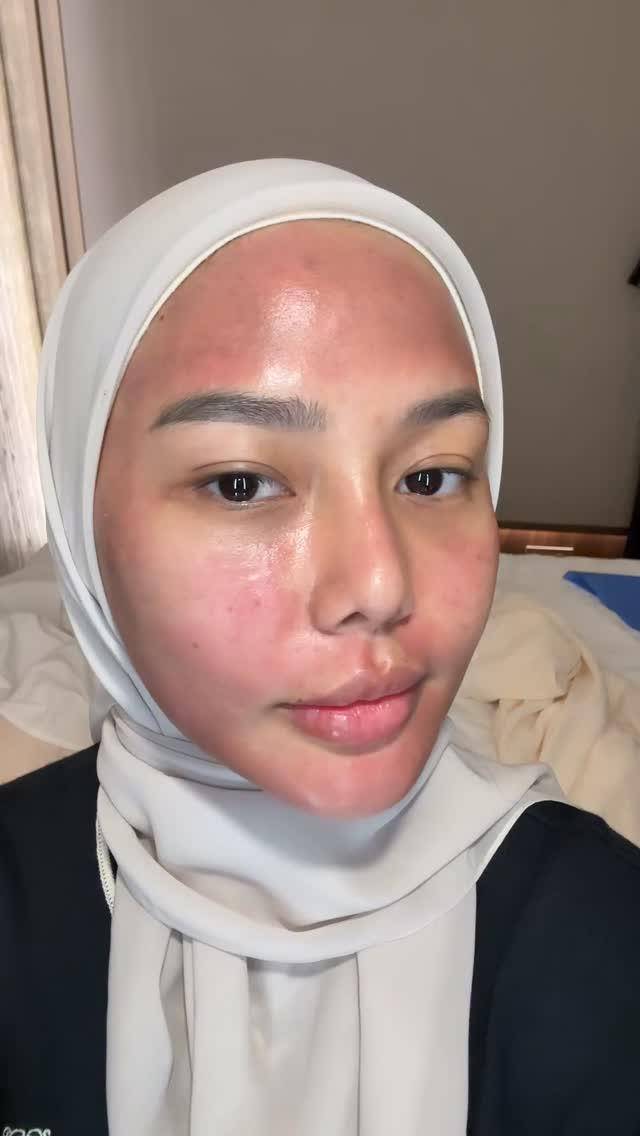 potret Dara Arafah