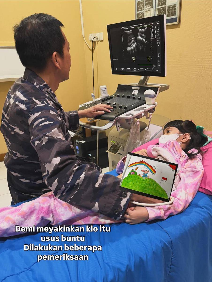 anak Nycta Gina operasi usus buntu 