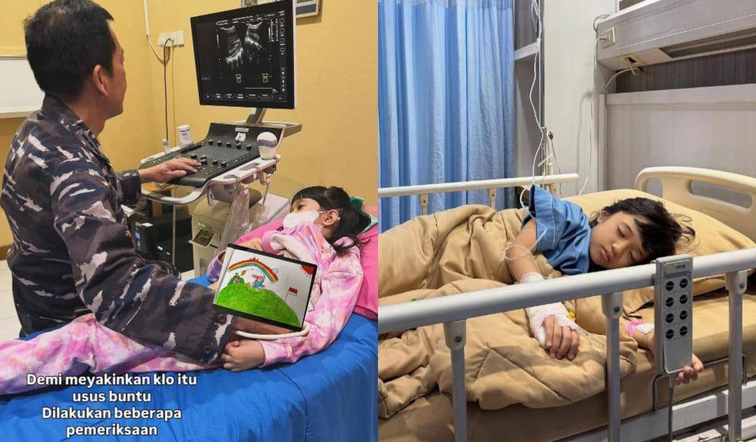 anak Nycta Gina operasi usus buntu 