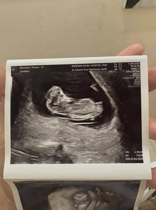 Theresa Wienathan Umumkan Kehamilan Kedua (Instagram.com/theresawienathan)