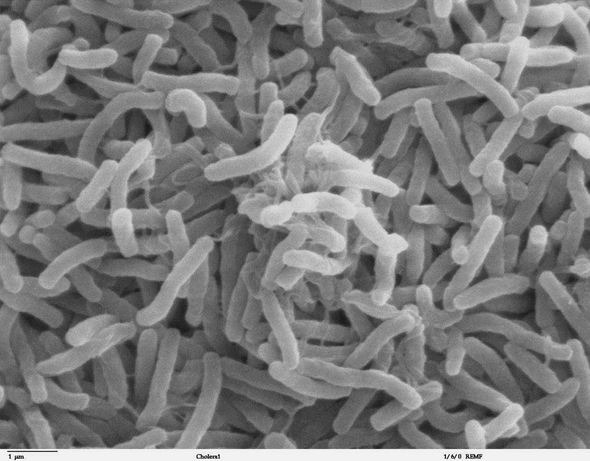 Gambar mikroskop elektron bakteri Vibrio cholerae yang menginfeksi sistem pencernaan. (commons.wikimedia.org/http://remf.dartmouth.edu/imagesindex.html)
