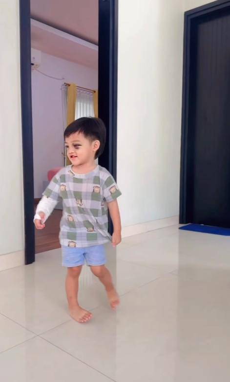 Kondisi Anak Ricky Perdana Usai Jatuh (Instagram.com/rickyperdana06)