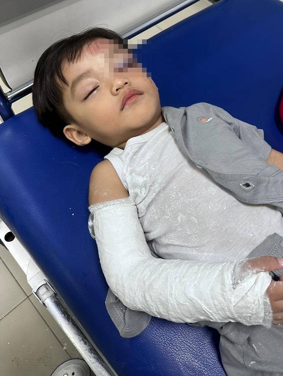 Kondisi Anak Ricky Perdana Usai Jatuh (Instagram.com/rickyperdana06)