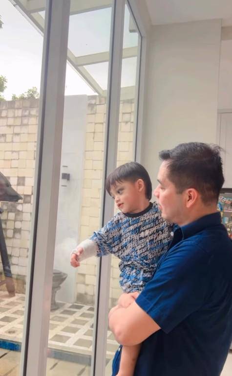 Kondisi Anak Ricky Perdana Usai Jatuh (Instagram.com/rickyperdana06)