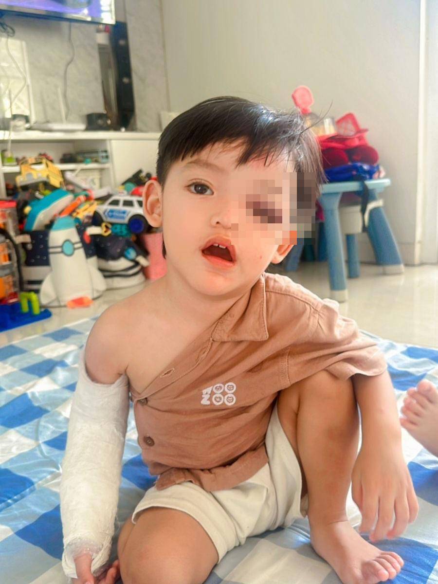 Kondisi Anak Ricky Perdana Usai Jatuh (Instagram.com/rickyperdana06)